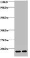 Hemoglobin Subunit Alpha 2 antibody, A57569-100, Epigentek, Western Blot image 