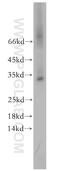 Chromosome 2 Open Reading Frame 49 antibody, 18272-1-AP, Proteintech Group, Western Blot image 