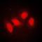 Protein SMG7 antibody, orb214942, Biorbyt, Immunofluorescence image 