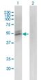 Aminocarboxymuconate Semialdehyde Decarboxylase antibody, H00130013-M01, Novus Biologicals, Western Blot image 