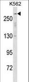 Sodium Voltage-Gated Channel Alpha Subunit 5 antibody, LS-C158925, Lifespan Biosciences, Western Blot image 
