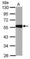 Aldehyde Dehydrogenase 1 Family Member A1 antibody, GTX100043, GeneTex, Western Blot image 