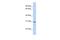 Ring Finger Protein 148 antibody, A16768, Boster Biological Technology, Western Blot image 