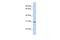 Ring Finger Protein 148 antibody, A16768, Boster Biological Technology, Western Blot image 