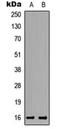 Transition Protein 2 antibody, orb234972, Biorbyt, Western Blot image 