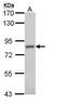 Activin A Receptor Type 1 antibody, NBP1-33096, Novus Biologicals, Western Blot image 