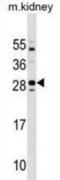 Transmembrane Protein 125 antibody, abx030869, Abbexa, Western Blot image 
