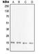 PRA1 Domain Family Member 2 antibody, LS-C353311, Lifespan Biosciences, Western Blot image 