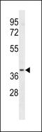 Leukotriene B4 Receptor 2 antibody, 58-279, ProSci, Western Blot image 