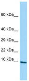 Plasminogen Like B2 antibody, TA331283, Origene, Western Blot image 