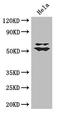 Kruppel Like Factor 5 antibody, LS-C500686, Lifespan Biosciences, Western Blot image 