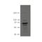 Plakophilin 3 antibody, IQ574, Immuquest, Immunohistochemistry paraffin image 