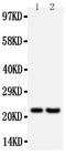 Fibroblast Growth Factor 9 antibody, PA1453, Boster Biological Technology, Western Blot image 