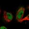 N-Terminal Xaa-Pro-Lys N-Methyltransferase 1 antibody, PA5-54144, Invitrogen Antibodies, Immunofluorescence image 