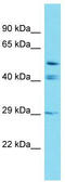 Glutaredoxin And Cysteine Rich Domain Containing 2 antibody, TA337334, Origene, Western Blot image 