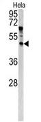 Angiopoietin-related protein 7 antibody, AP17106PU-N, Origene, Western Blot image 