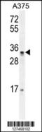 Pseudouridine Synthase Like 1 antibody, 55-256, ProSci, Western Blot image 