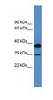 Actin Related Protein 2/3 Complex Subunit 2 antibody, orb330986, Biorbyt, Western Blot image 