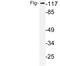 Fibroblast Growth Factor Receptor 1 antibody, LS-C176623, Lifespan Biosciences, Western Blot image 