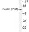 Paxillin antibody, LS-C178001, Lifespan Biosciences, Western Blot image 