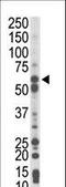 Phosphoenolpyruvate Carboxykinase 1 antibody, LS-C101193, Lifespan Biosciences, Western Blot image 