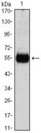 Cyclin Dependent Kinase Inhibitor 1B antibody, GTX82990, GeneTex, Western Blot image 