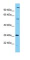 Chromosome 17 Open Reading Frame 99 antibody, orb327160, Biorbyt, Western Blot image 