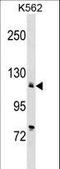 ATPase Sarcoplasmic/Endoplasmic Reticulum Ca2+ Transporting 2 antibody, LS-C156649, Lifespan Biosciences, Western Blot image 