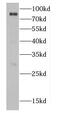 CBFA2/RUNX1 Partner Transcriptional Co-Repressor 2 antibody, FNab01315, FineTest, Western Blot image 