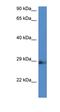 N(Alpha)-Acetyltransferase 11, NatA Catalytic Subunit antibody, orb325405, Biorbyt, Western Blot image 