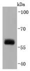 SRC Proto-Oncogene, Non-Receptor Tyrosine Kinase antibody, NBP2-67167, Novus Biologicals, Western Blot image 
