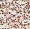 Autophagy Related 9A antibody, LS-C156623, Lifespan Biosciences, Immunohistochemistry paraffin image 