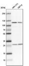 Alanyl-TRNA Synthetase antibody, PA5-59335, Invitrogen Antibodies, Western Blot image 