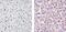 C-Reactive Protein antibody, 710269, Invitrogen Antibodies, Immunohistochemistry frozen image 