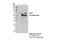 Enhancer Of MRNA Decapping 3 antibody, 14495S, Cell Signaling Technology, Immunoprecipitation image 