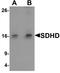 Succinate Dehydrogenase Complex Subunit D antibody, TA326622, Origene, Western Blot image 