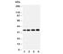Hydroxysteroid 17-Beta Dehydrogenase 1 antibody, R30694, NSJ Bioreagents, Western Blot image 