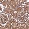 Coatomer Protein Complex Subunit Gamma 1 antibody, PA5-65194, Invitrogen Antibodies, Immunohistochemistry paraffin image 