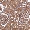 Coatomer Protein Complex Subunit Gamma 1 antibody, PA5-65194, Invitrogen Antibodies, Immunohistochemistry paraffin image 