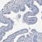 Zinc Finger CCHC-Type Containing 12 antibody, PA5-57088, Invitrogen Antibodies, Immunohistochemistry frozen image 