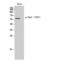 Checkpoint Kinase 2 antibody, LS-C381230, Lifespan Biosciences, Western Blot image 