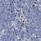 S100 Calcium Binding Protein A8 antibody, NBP1-90314, Novus Biologicals, Immunohistochemistry frozen image 