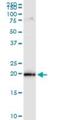 Mitochondrial Ribosomal Protein S25 antibody, H00064432-M01, Novus Biologicals, Western Blot image 