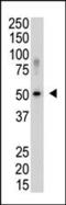 SUMO Specific Peptidase 5 antibody, PA5-11335, Invitrogen Antibodies, Western Blot image 