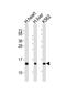Hemoglobin Subunit Beta antibody, MBS9201956, MyBioSource, Western Blot image 