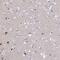 Acid Phosphatase 7, Tartrate Resistant (Putative) antibody, PA5-60047, Invitrogen Antibodies, Immunohistochemistry paraffin image 