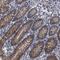 Endoplasmic Reticulum Metallopeptidase 1 antibody, NBP2-13970, Novus Biologicals, Immunohistochemistry paraffin image 