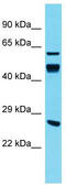 DnaJ Heat Shock Protein Family (Hsp40) Member A4 antibody, TA344847, Origene, Western Blot image 