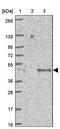 Armadillo Repeat Containing X-Linked 3 antibody, PA5-51376, Invitrogen Antibodies, Western Blot image 