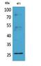 CD81 Molecule antibody, A01281-1, Boster Biological Technology, Western Blot image 